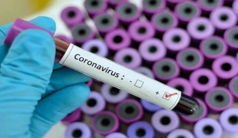 ՀՀ առողջապահության նախարարությունը տեսանյութ է հրապարակել՝ կորոնավիրուսային հիվանդության համար ախտորոշիչ թեստավորման մասին