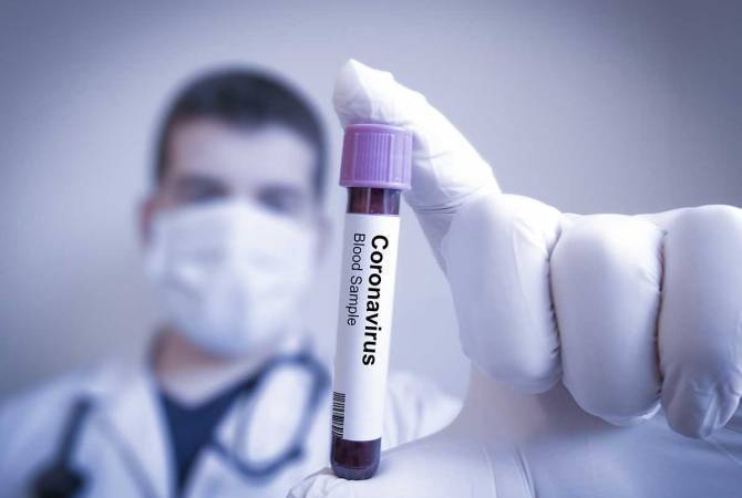 В Армении подтверждено 370 новых случаев COVID-19, выздоровели 67