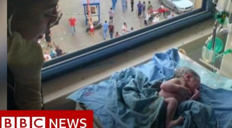 Բեյրութի բնակչուհիներից մեկը ծննդաբերելիս է եղել, երբ որոտացել է պայթյունը՝ ցնցելով հիվանդանոցը (տեսանյութ)