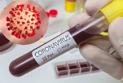 New record high 1,540 more cases of COVID-19 confirmed in Armenia