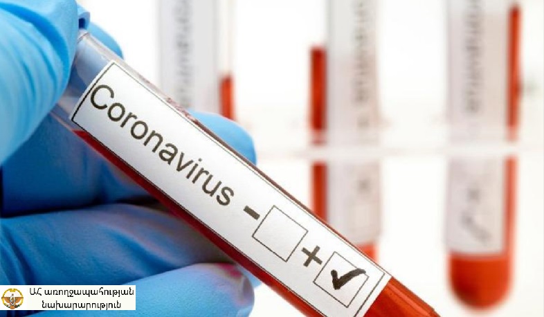 Հայաստանում արձանագրվել է կորոնավիրուսային հիվանդության 3956, Արցախում՝ 38 նոր դեպք